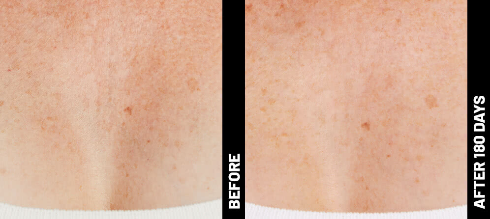 Blinder Debbie Decolletage After 180